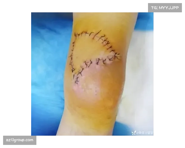 切尔西左中卫位置长期真空 科尔威尔膝关节受伤预计五月底才能复出